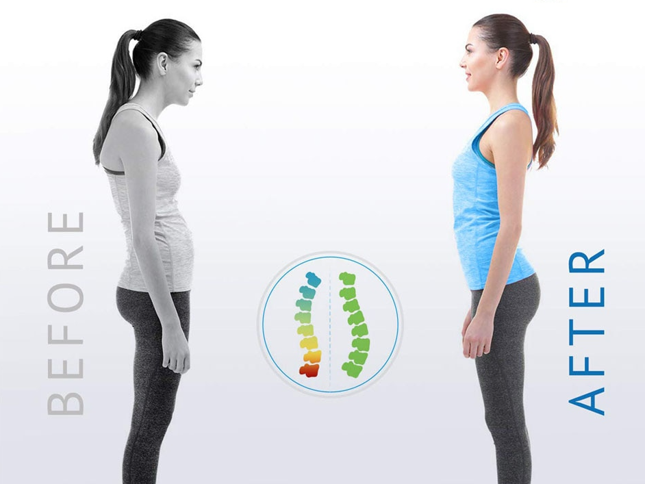 Posture Corrector – Lightweight, Adjustable, Discreet Under Clothing